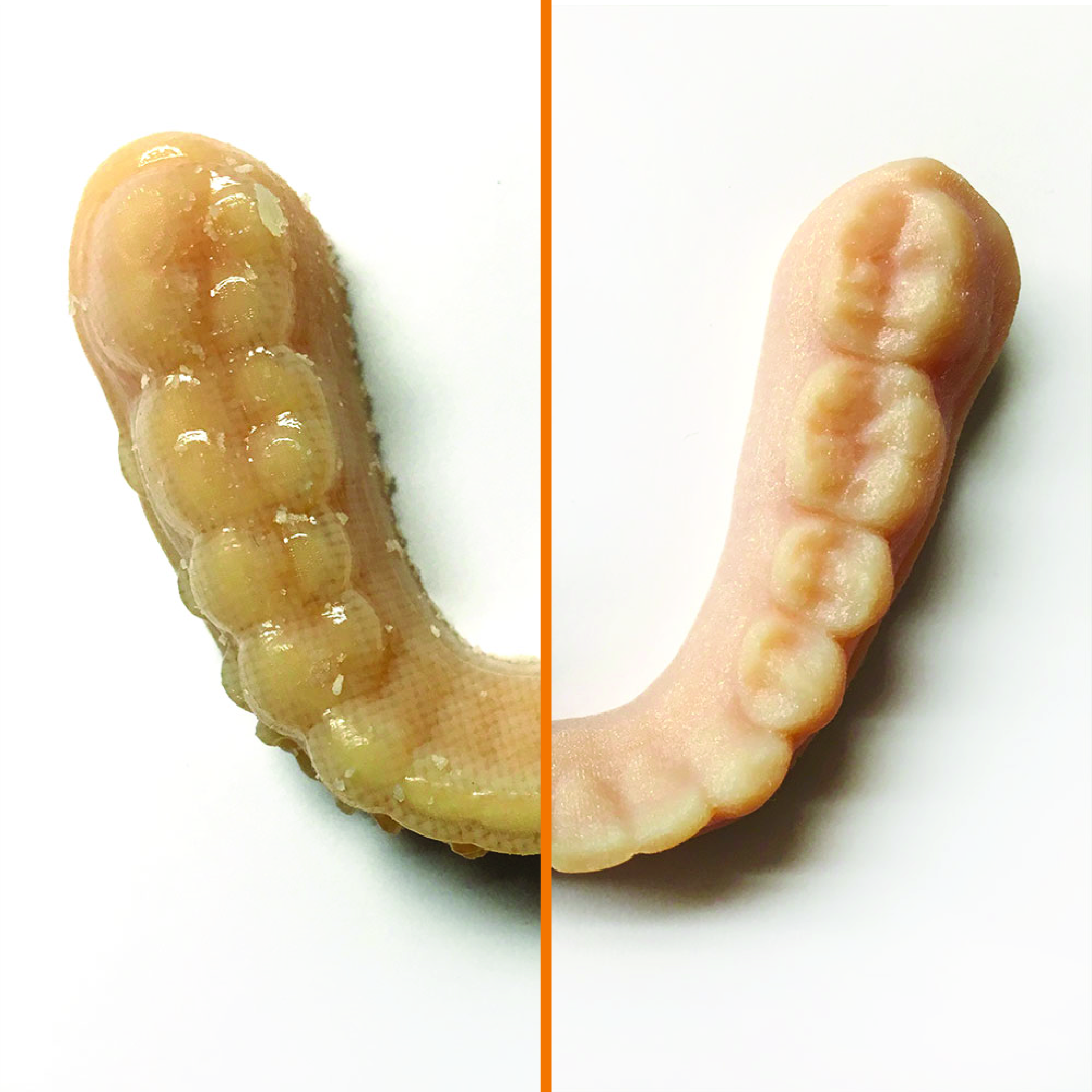teeth-before-after-01